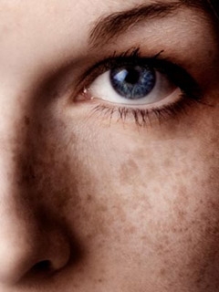 Treat-the-dark-spots-on-face